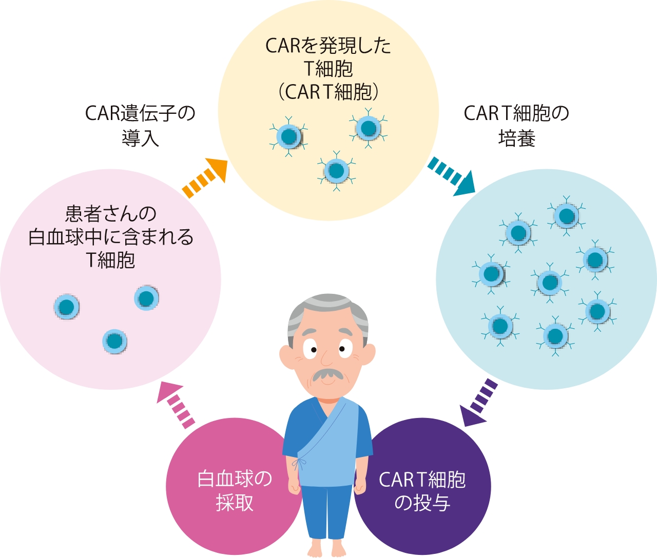 CARを発現したT細胞(CAR T細胞) CAR T細胞の培養 CAR T細胞の投与 白血球の採取 患者さんの白血球に含まれるT細胞 CAR遺伝子の導入